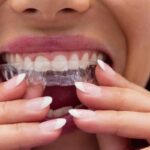 Comment l’orthodontie améliore la digestion ?
